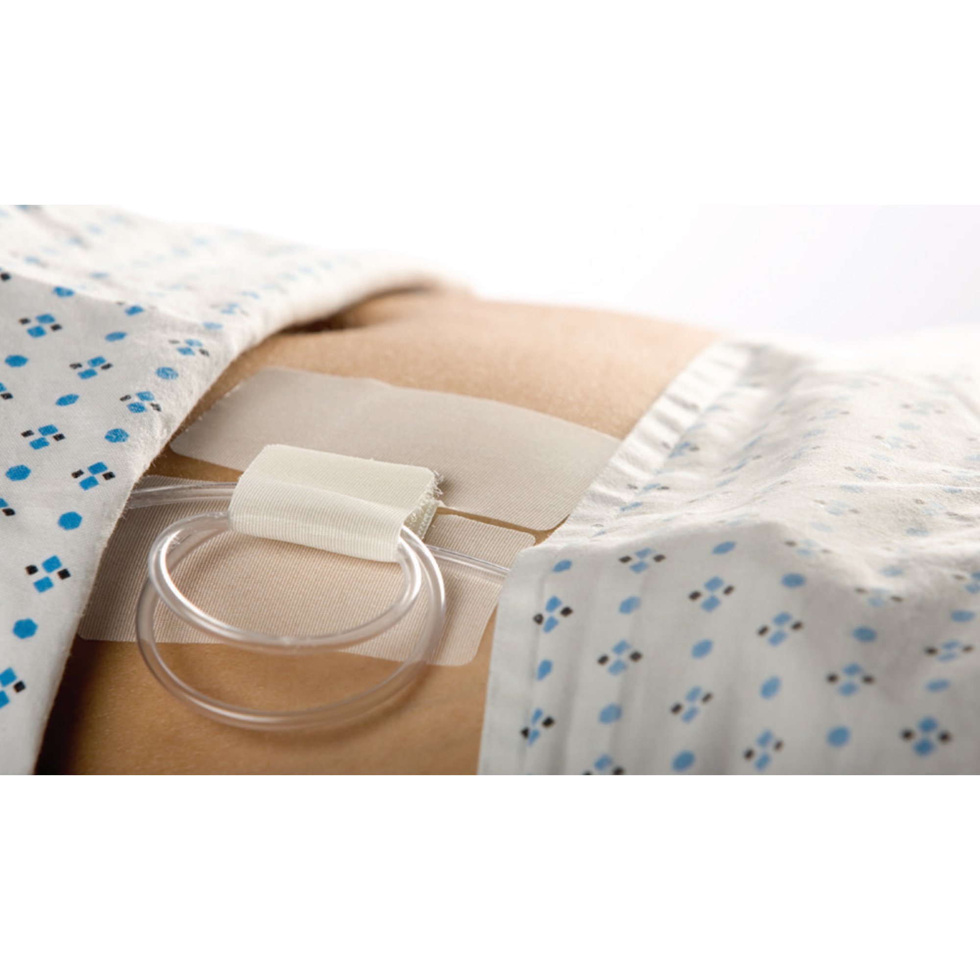 M.C. Johnson 5445-2 - Cath-Secure™ Holder, Tube - 1/Each, 50/Box