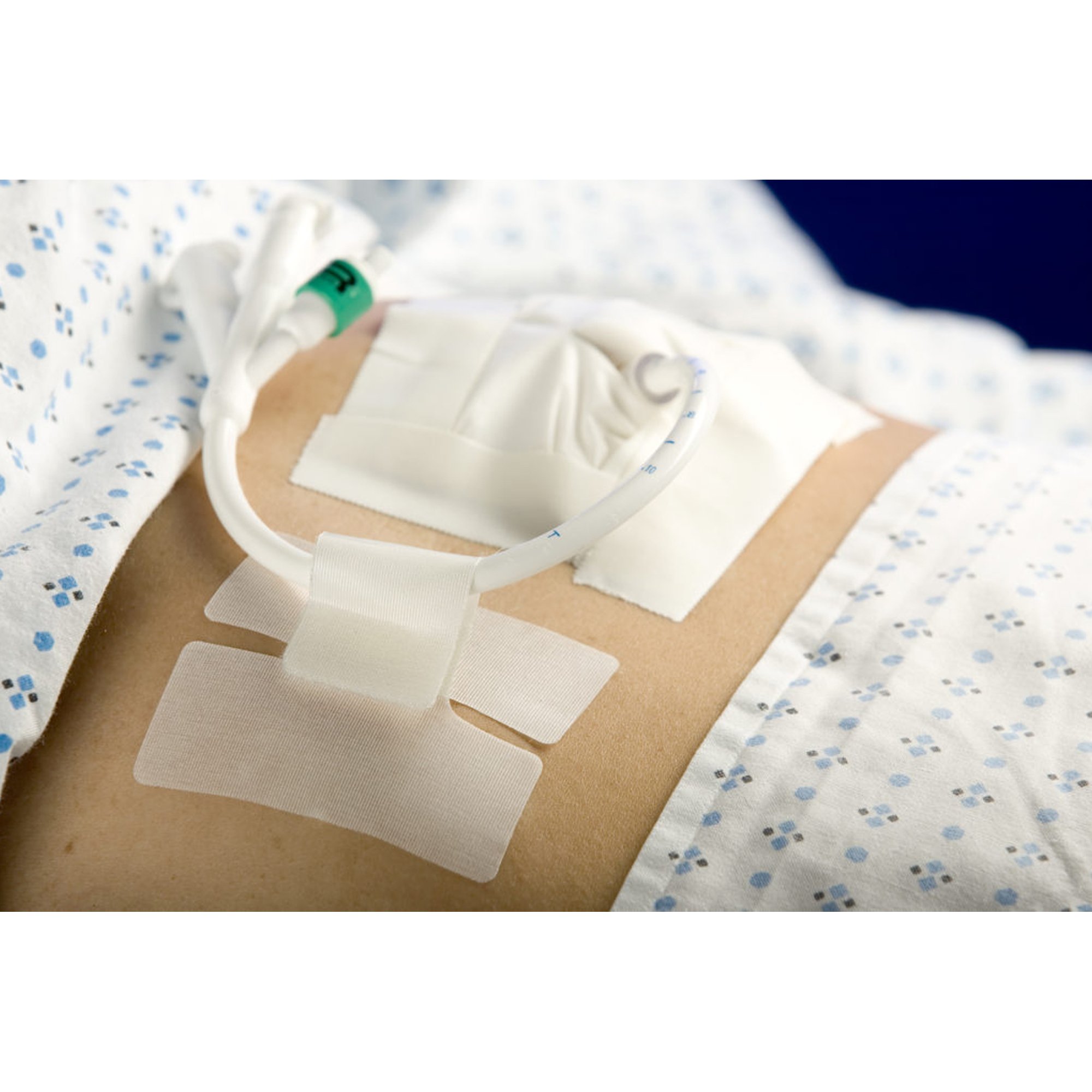 M.C. Johnson - 5445-2 Cath-Secure™ Holder