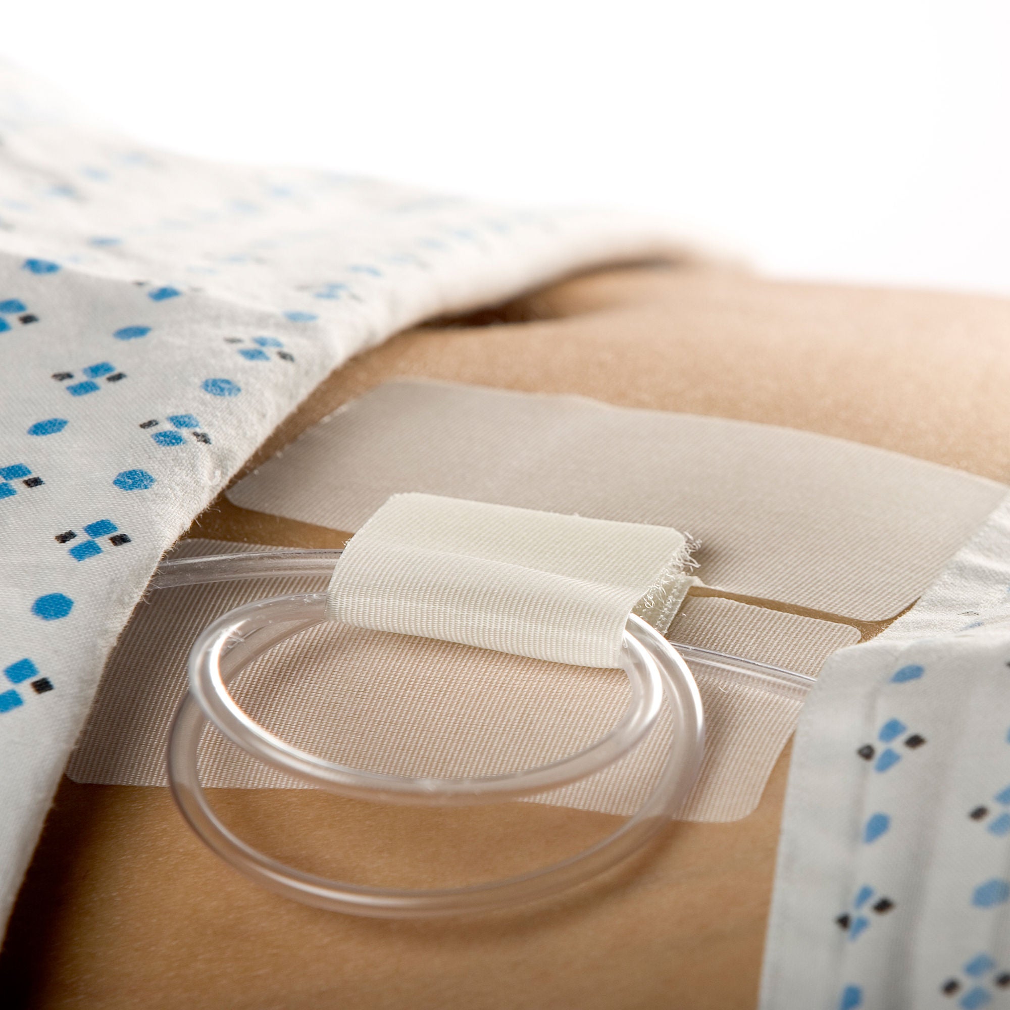 M.C. Johnson - 5445-2 Cath-Secure™ Holder, Tube