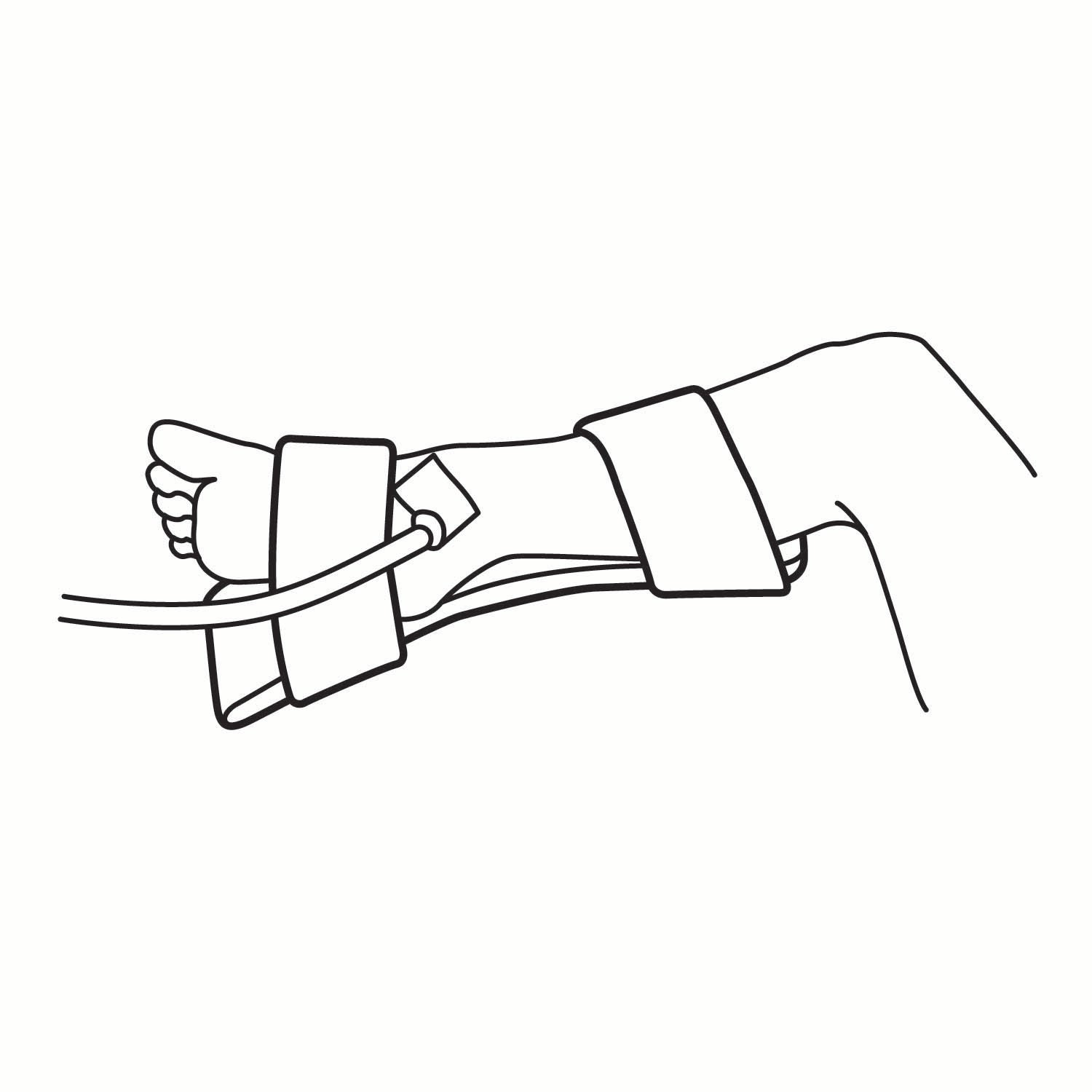 O&M Halyard Inc - 29965 IV Armboard 1-1/2 X 3-1/2 Inch Neonatal Flexible