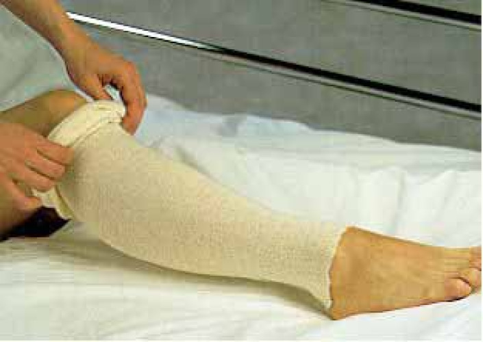 The Pillow Factory Division 81320 - AlbaHealth® Natural Cotton Tubular Stockinette, 3 Inch x 25 Yard - 1/Each, 12/Case