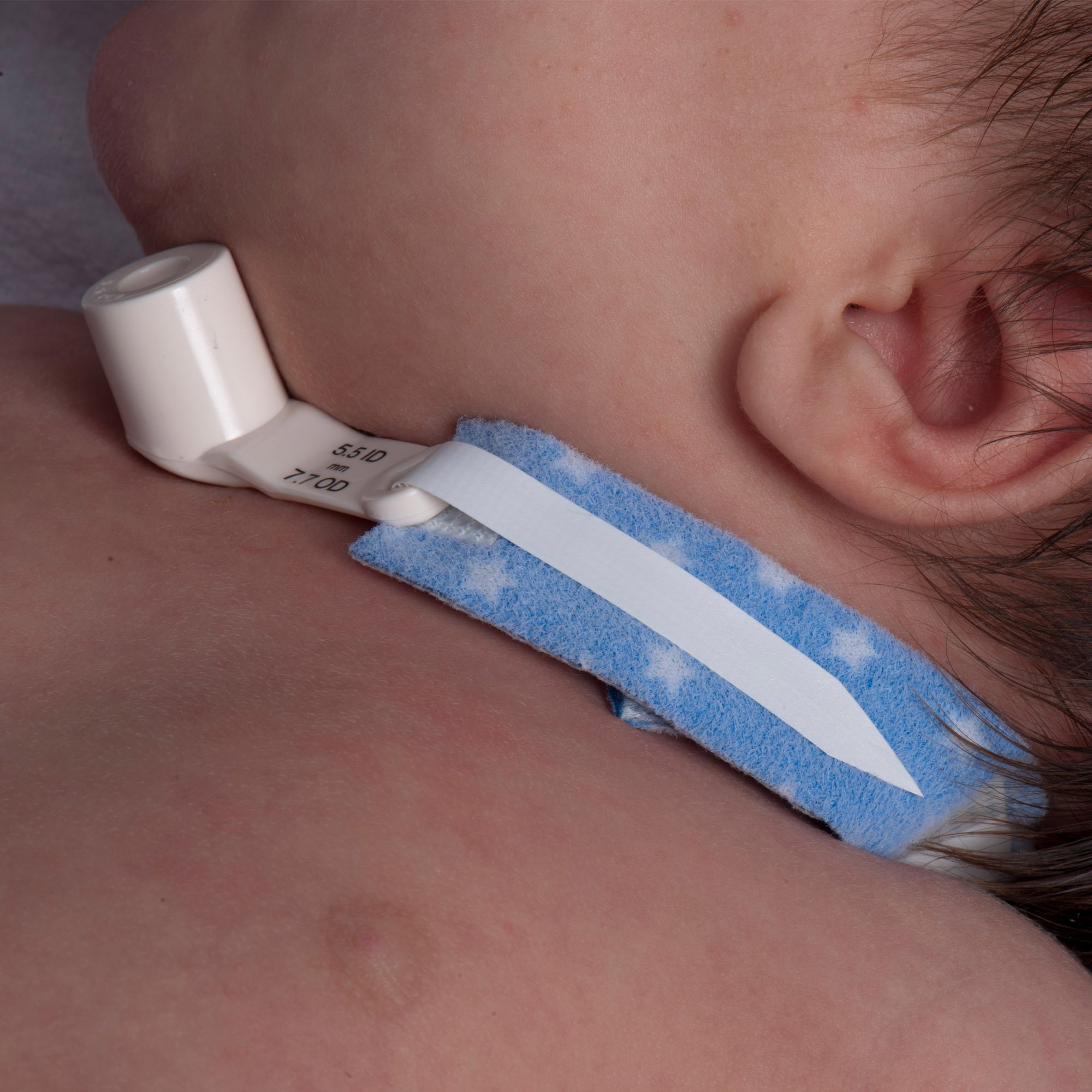 Dale Medical Products - 242 PediPrints™ Tracheostomy Tube Holder