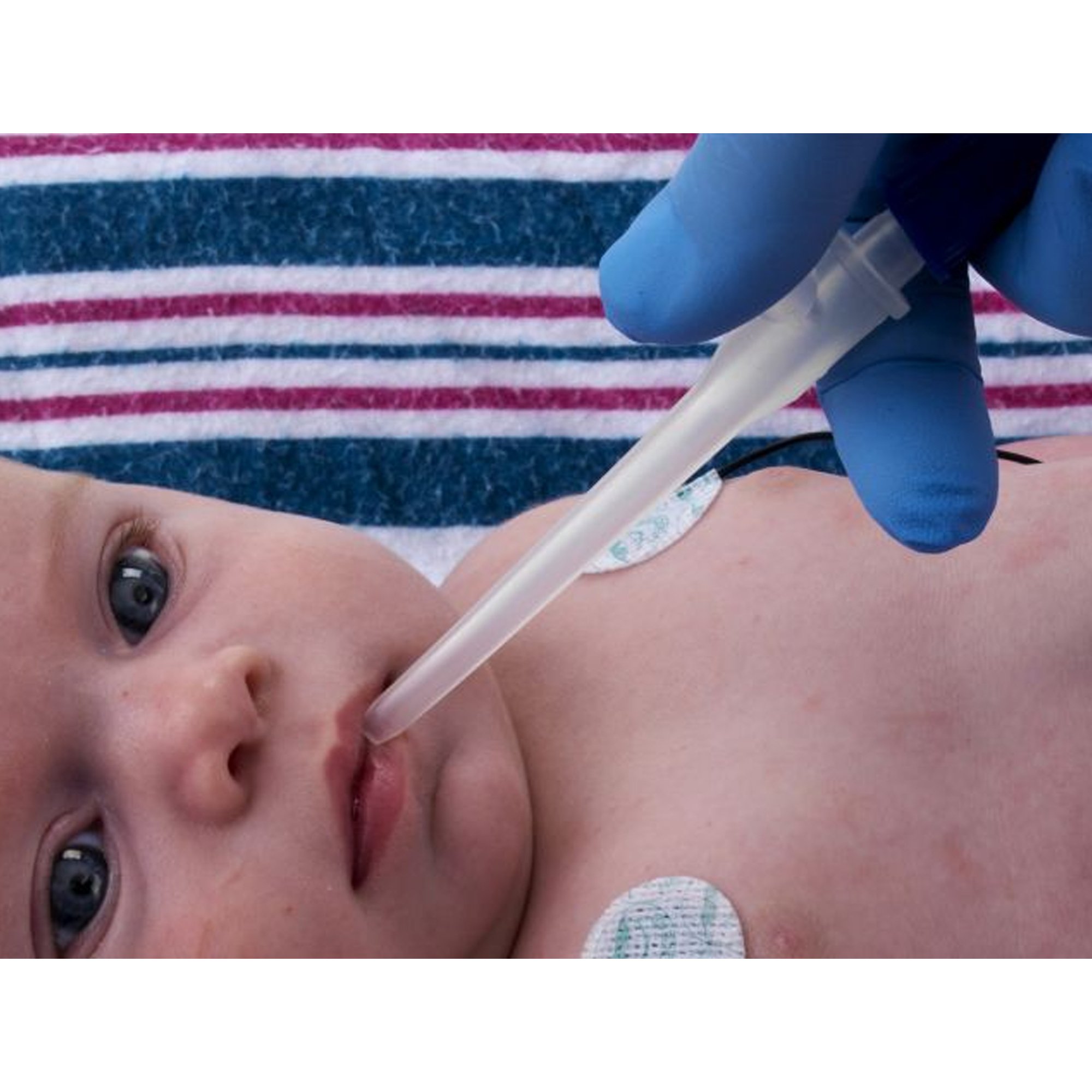 Neotech Products N205 - Little Sucker® Standard Style Suction Device, Oral and Nasal Type - 1/Each, 50/Case