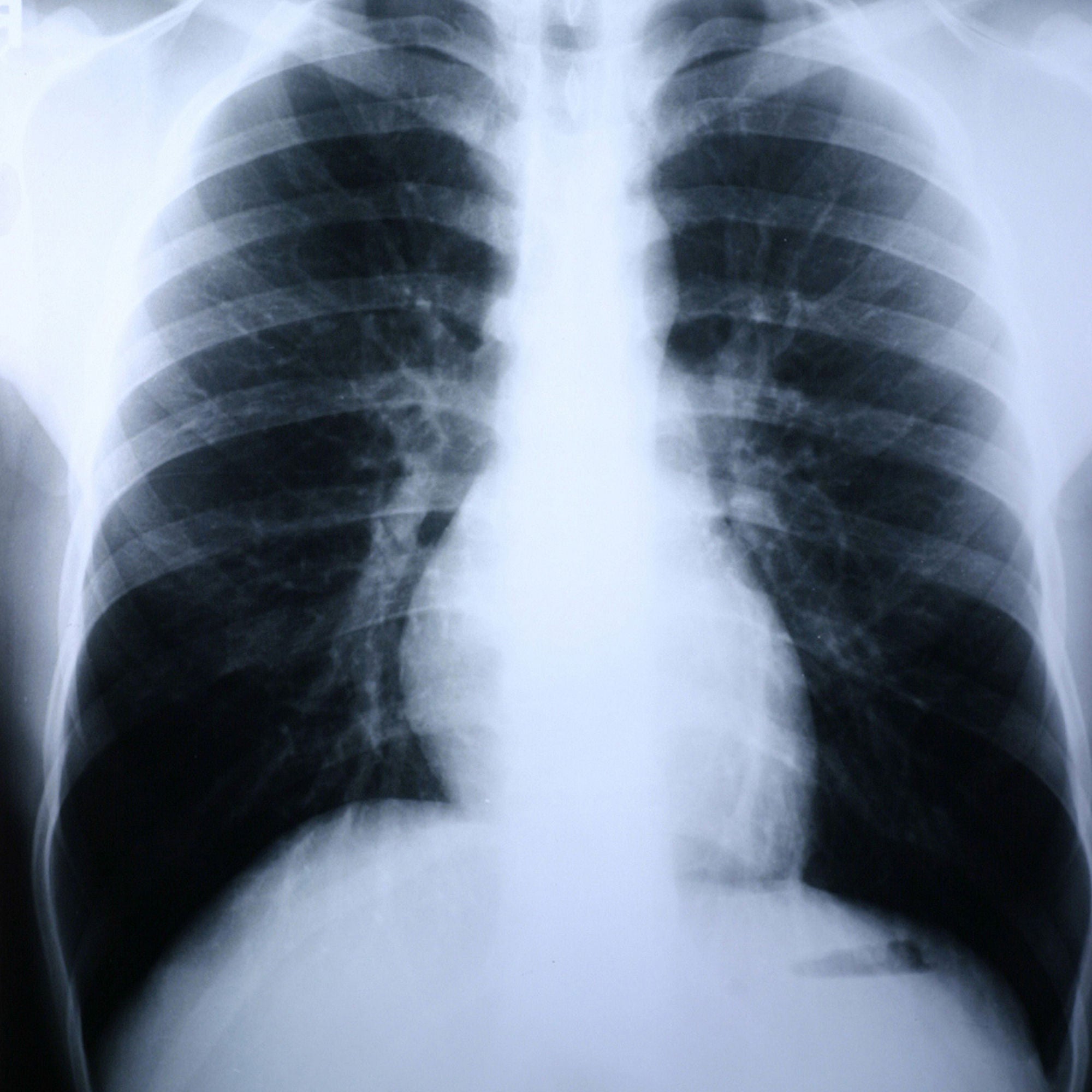 McKesson Brand - 55BTL Clear Choice™ Performance X-Ray Film