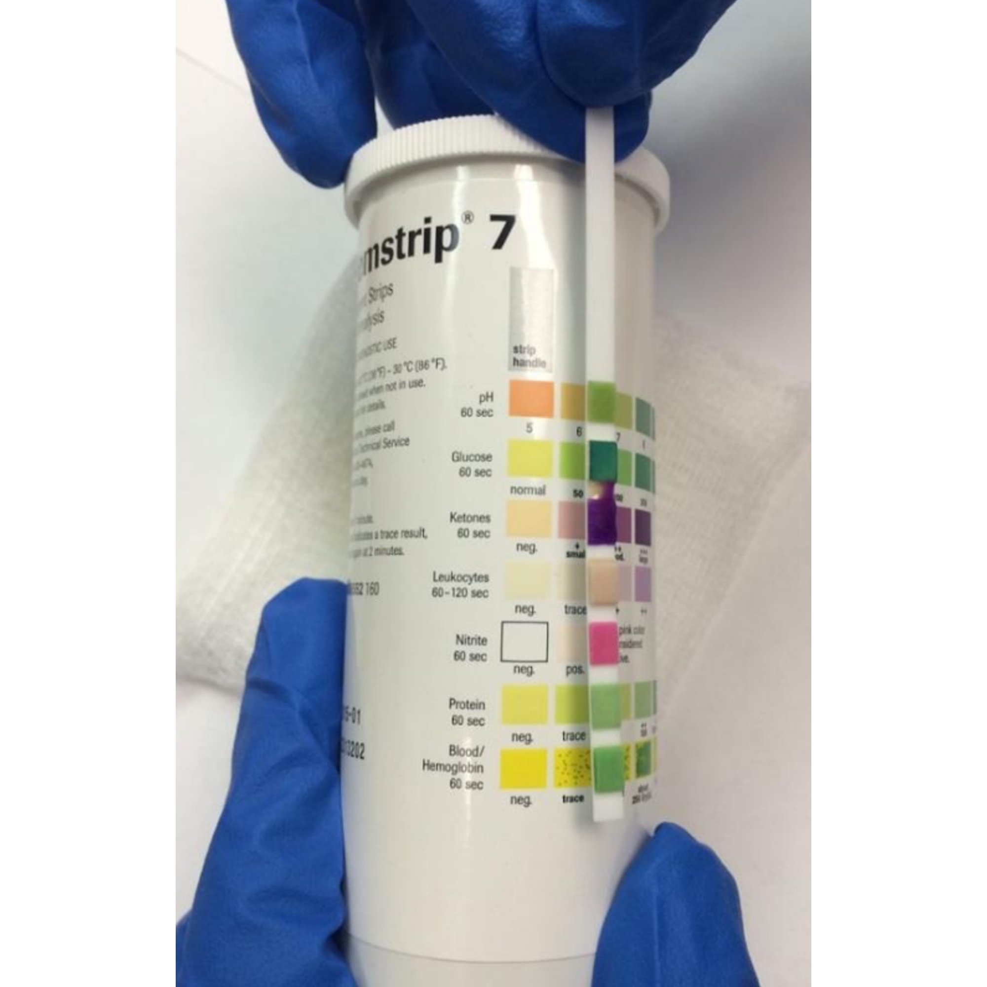 Roche Diagnostics - 11008552160 Chemstrip® 7 Urinalysis Reagent