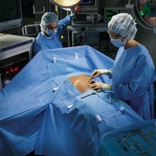 O&M Halyard Inc - 89233 Abdominal Drape Laparoscopic / Abdominal Drape 100 W X 76 W X 124 L Inch Sterile