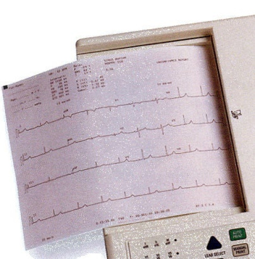 Welch Allyn - 94002-0000 Recording Chart Paper Welch Allyn® Z-Fold Red Grid