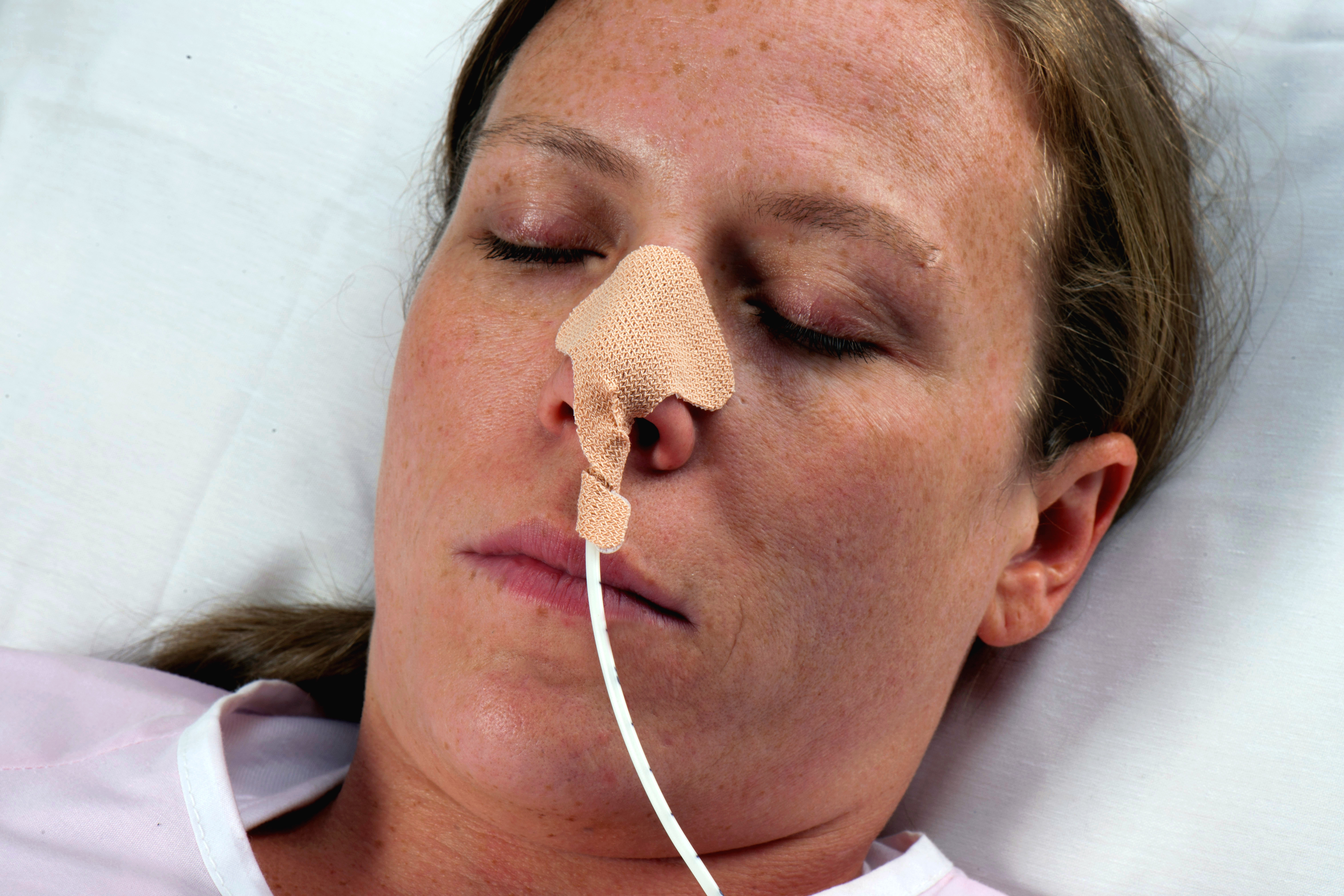 Dale Medical Products - 160 Dale® Nasogastric Tube Holder for Nasogastric Feeding and Aspiration Tubes