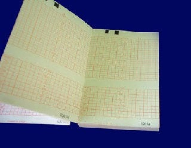 Electro Medical - CM1910A Recording Chart Paper Z-Fold Orange Grid