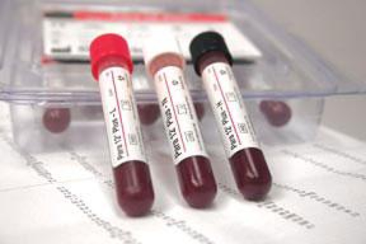 Streck Laboratories - 218913 Hematology Control Para 12® Plus 12 X 3 mL