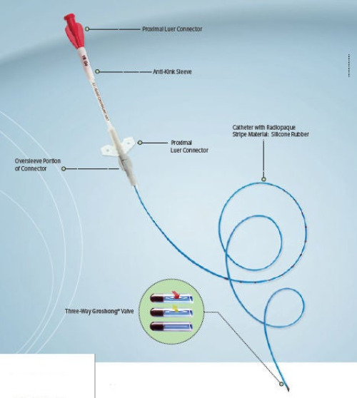 BD - 7617408 Central Venous Catheter Tray Groshong® Nxt Clearvue® 4 Fr. Single Lumen