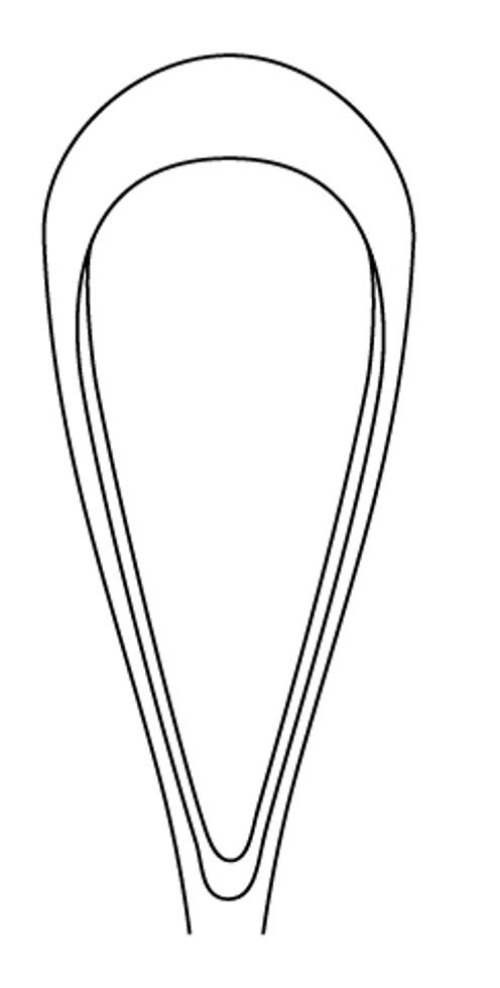 Integra Lifesciences - MH30-1205-1 Uterine Curette MeisterHand® Sims 11 Inch Length Hollow Handle with Grooves Size 1 Tip Sharp Teardrop Loop Tip