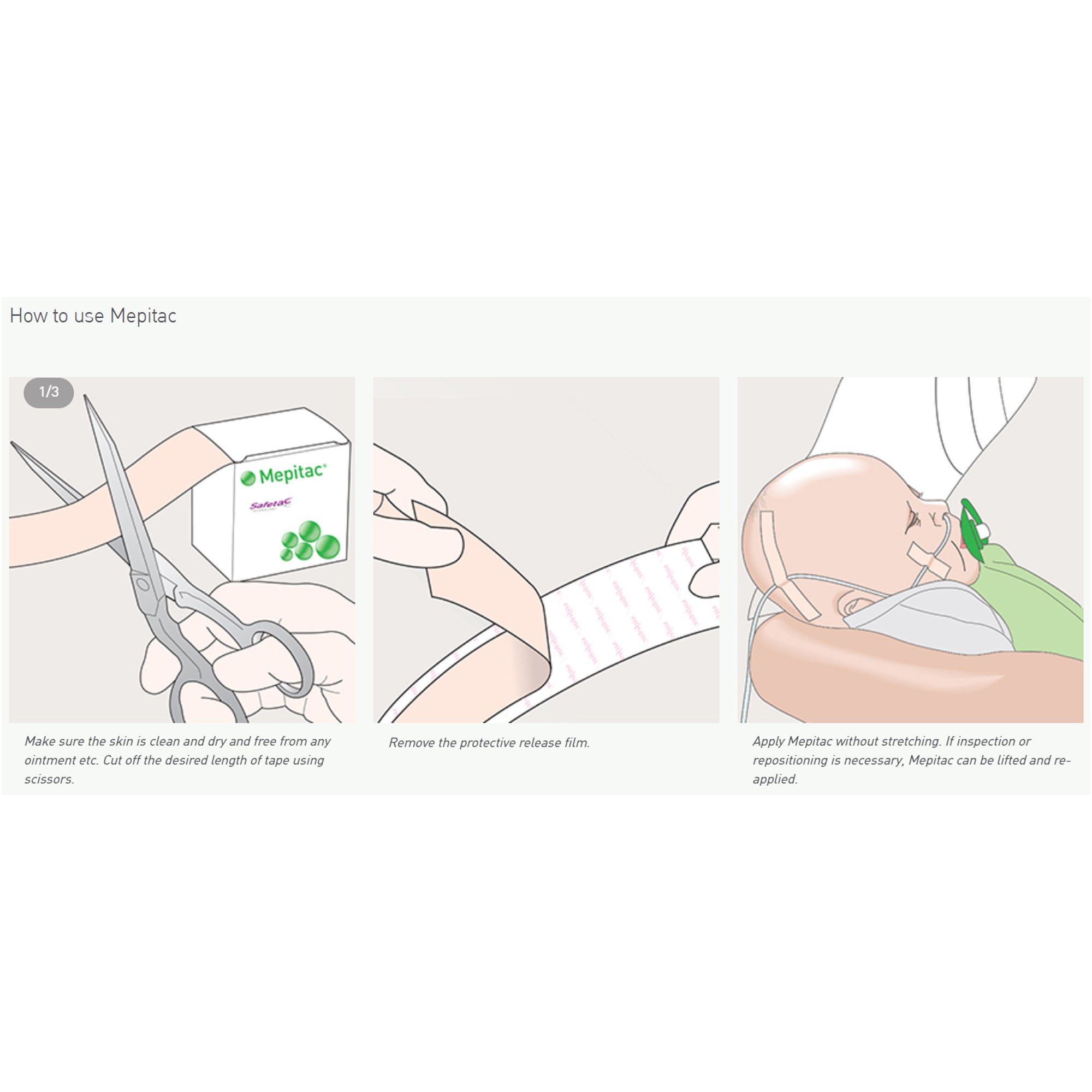 Mepitac Medical Tape 298300 by Molnlycke