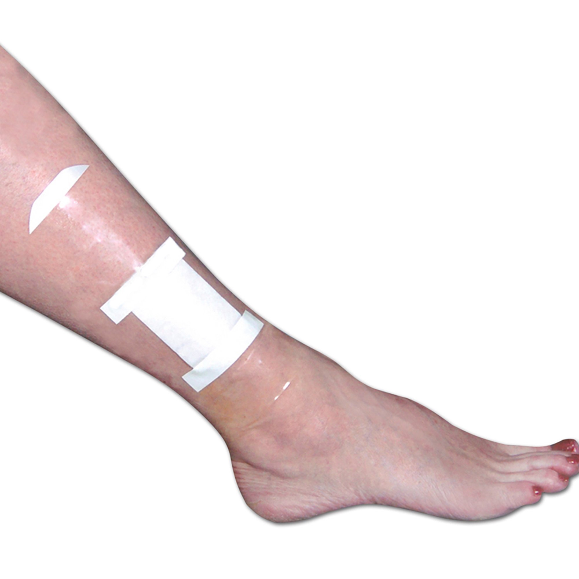 Brownmed - 20435 Seal-Tight® Shield Dressing