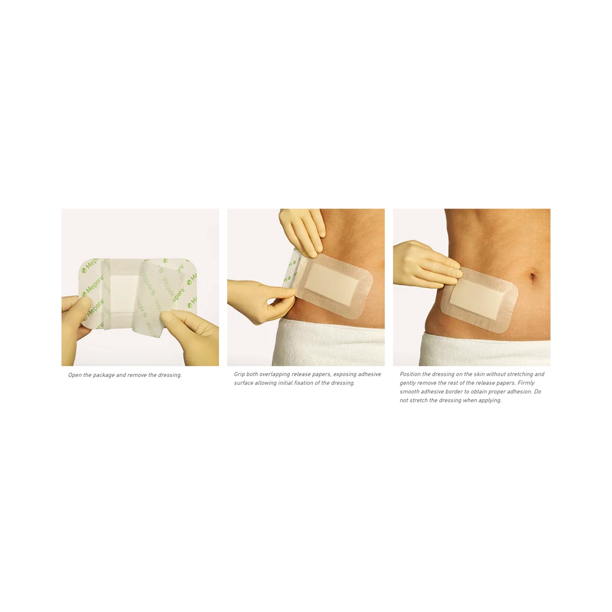Molnlycke - 670920 Mepore® Pro White Adhesive Dressing