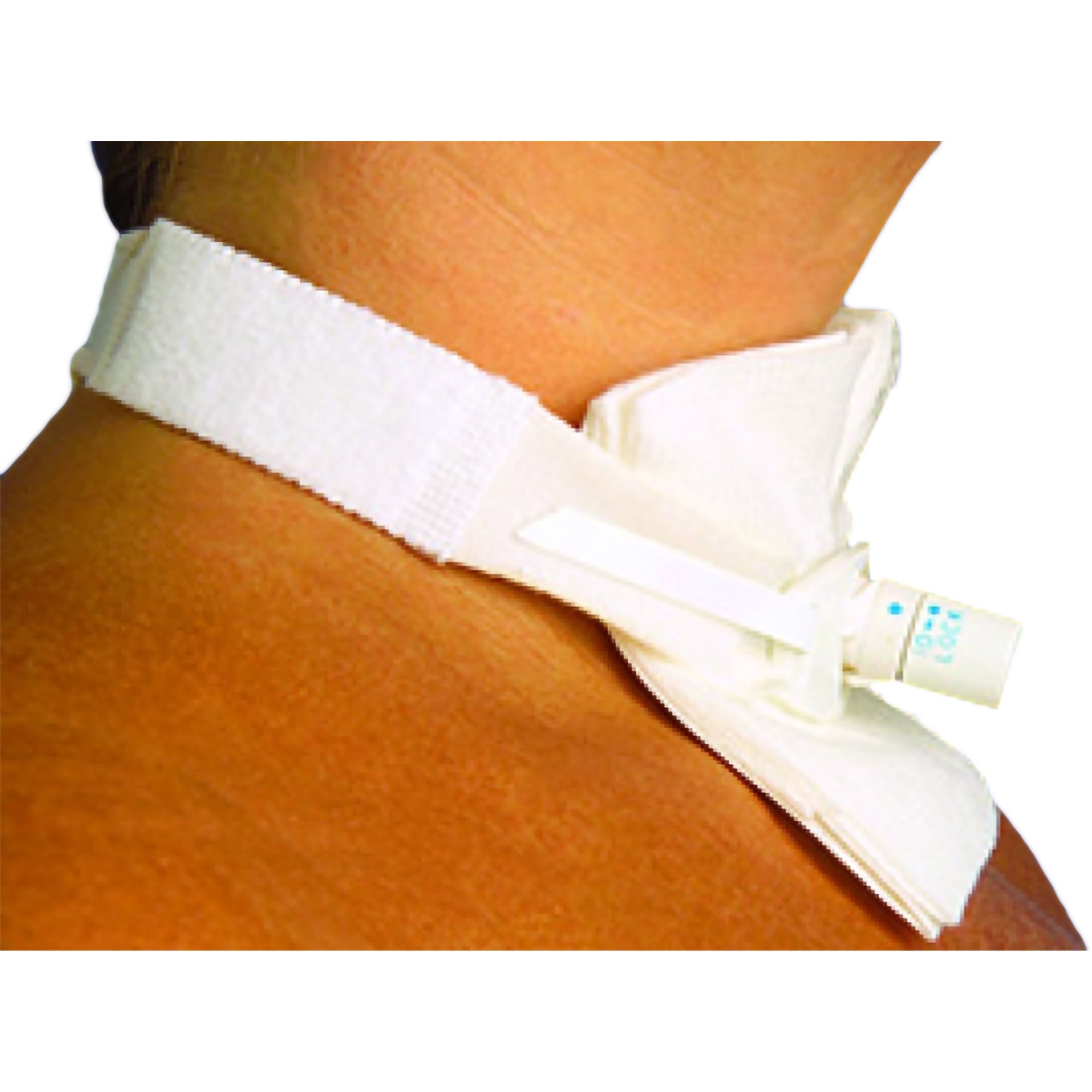 Pepper Medical - 501P Tracheostomy Tube Holder Pedi-Tie® 3/4 X 14 Inch Pediatric