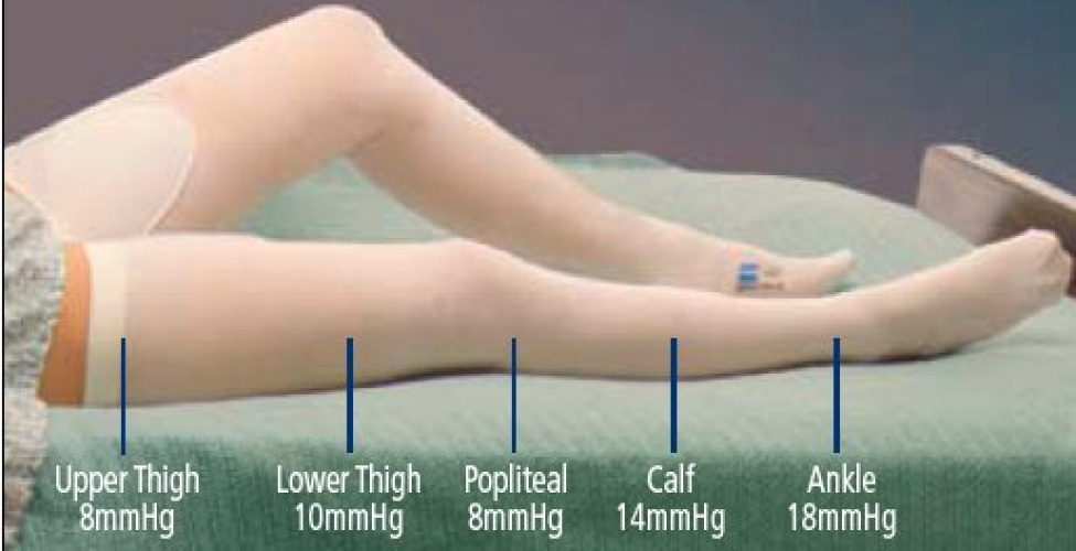 Cardinal - 3182LF T.E.D.™ Anti-embolism Stockings