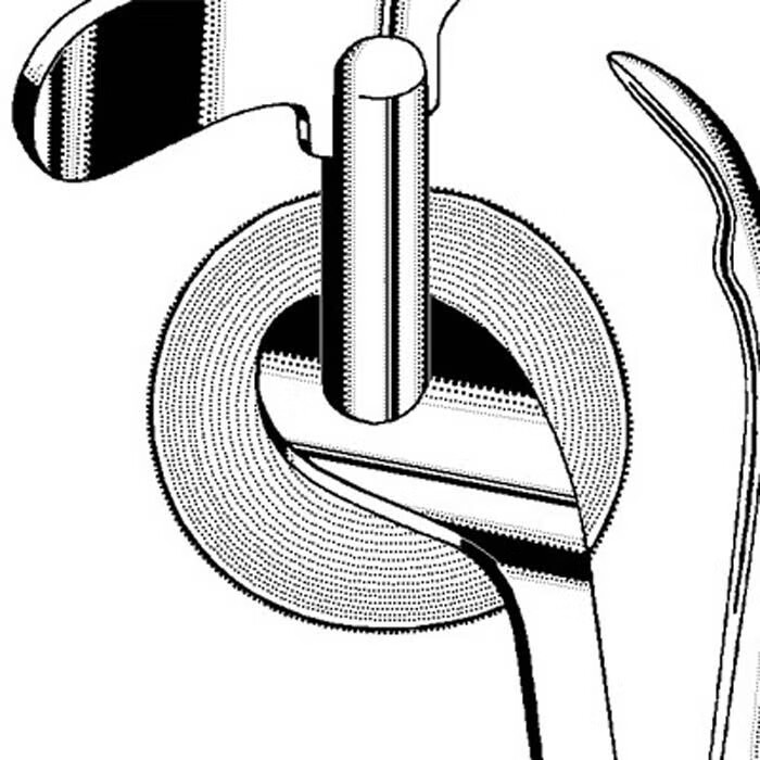 Sklar - 06-4151 Ring Cutter Blade Keyes Saw