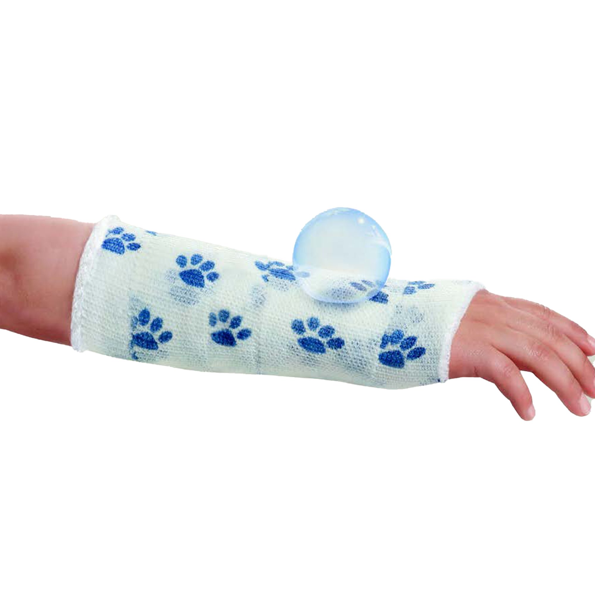 BSN Medical 7227320 - Delta-Cast® Prints Paw Print Cast Tape, 2 Inch x 4 Yard - 10/Box