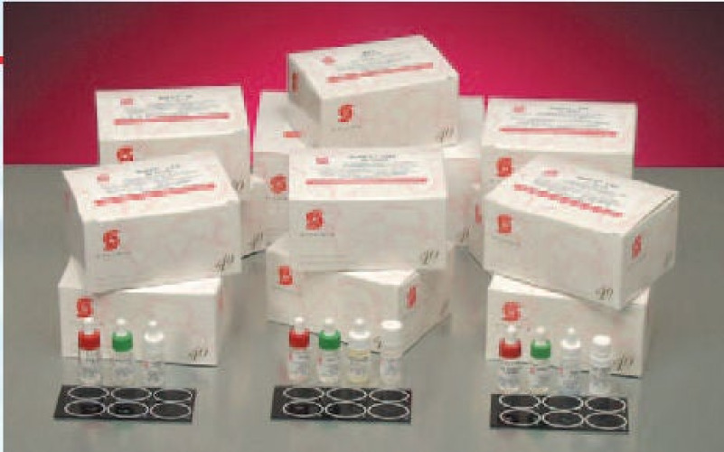 Stanbio Laboratory - 1170-100 Sexual Health Test Kit RPR Quicktest Syphilis Screen 100 Tests CLIA Non-Waived