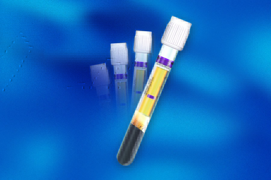 BD Vacutainer PPT Molecular Diagnostic Tube 362799 by BD