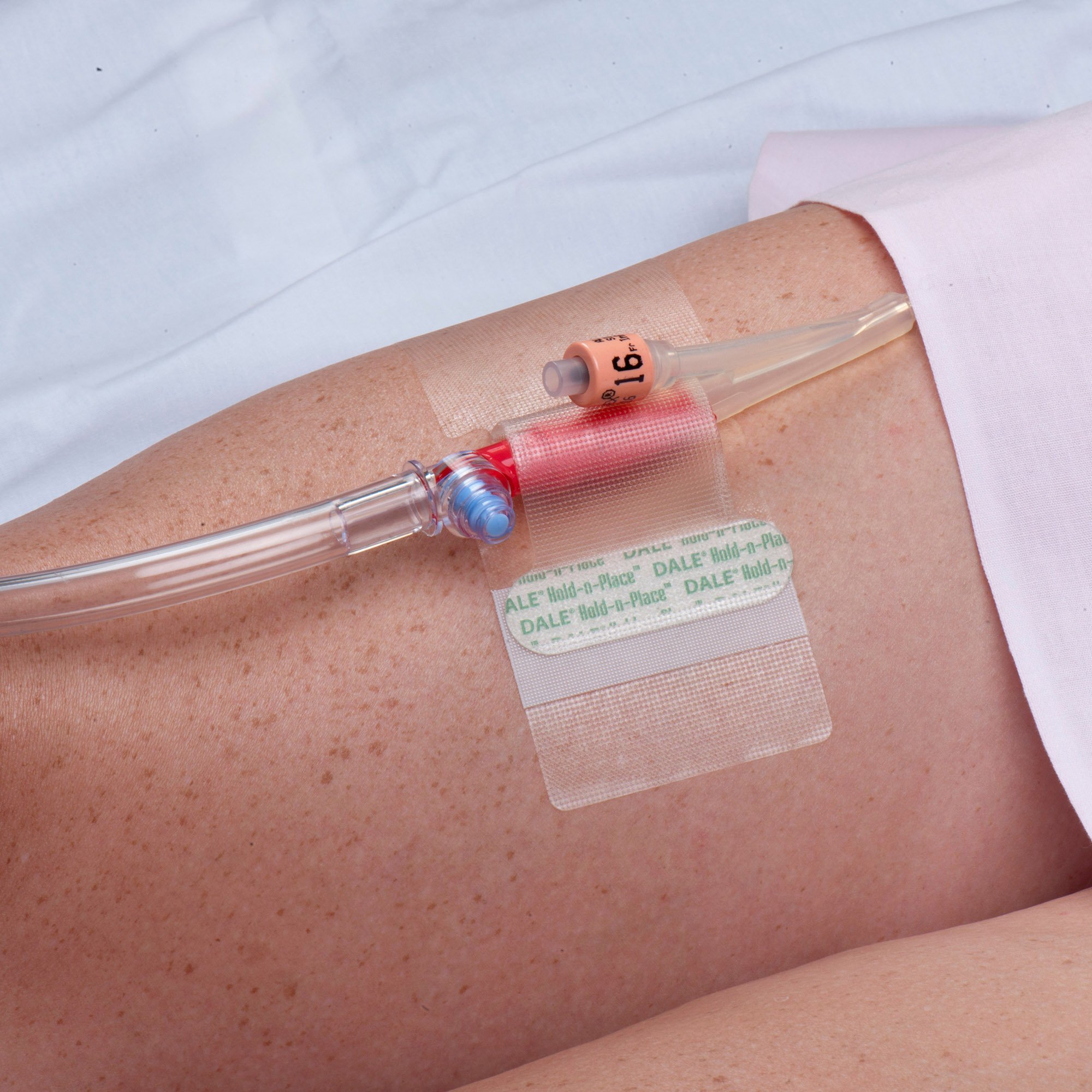 Dale Medical Products 150 - Dale® Hold-n-Place® Catheter Holder - 1/Each, 50/Box