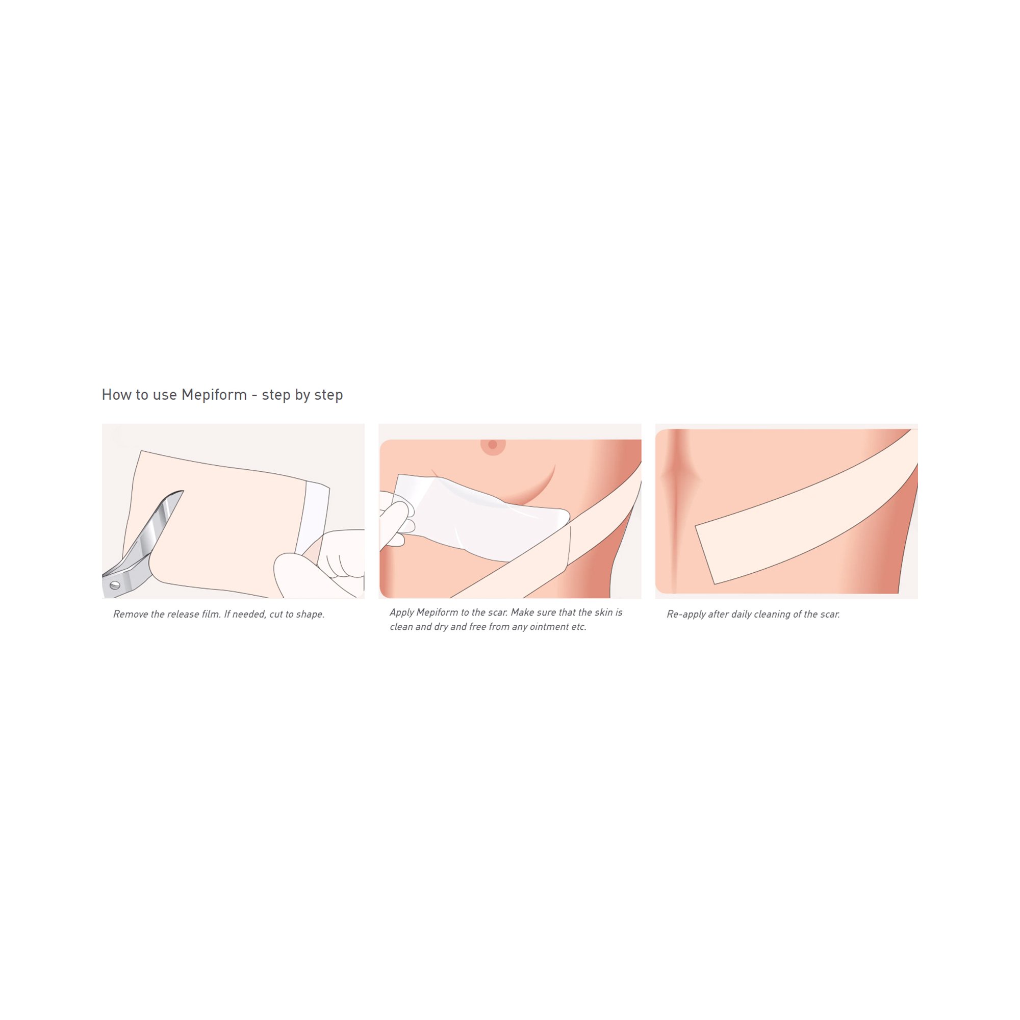 Mepiform Silicone Sheeting 293299 by Molnlycke