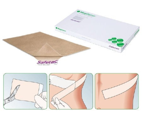Molnlycke - 293199 Silicone Sheeting Mepiform® 1-3/5 X 12 Inch Strip NonSterile