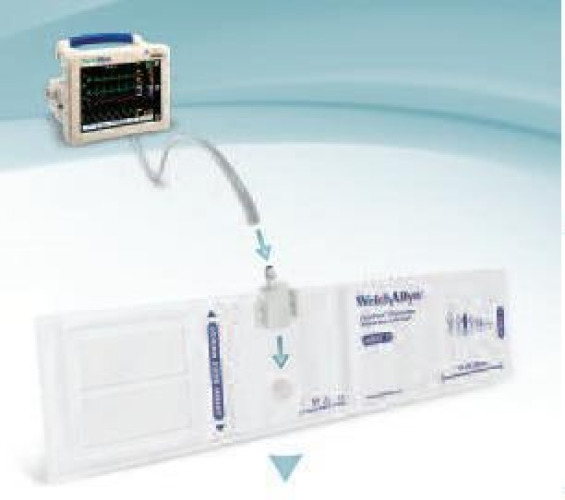 Welch Allyn - SOFT-07 Single Patient Use Blood Pressure Cuff FlexiPort® 9 to 13 cm Arm Cloth Fabric Cuff Infant Cuff