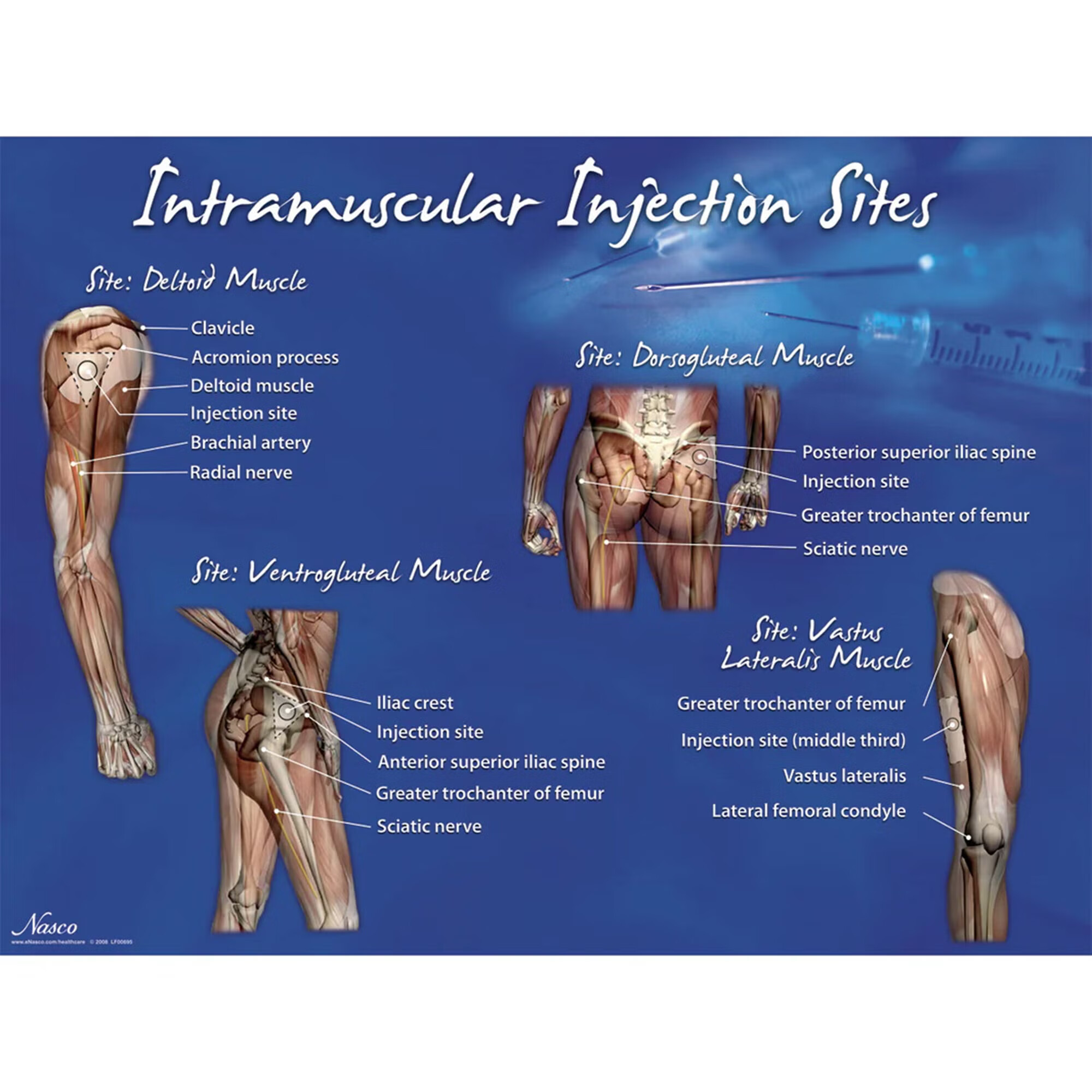 Nasco Healthcare - LF00695 Educational Poster Intramuscular Injection Sites Training Poster 18 X 24 Inch Heavy Paper Grommets Laminated