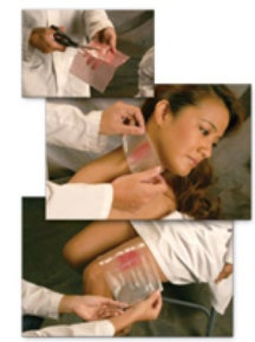 MPM Medical - MP00219 Hydrogel Wound Dressing CoolMagic™ 1-3/4 Inch Length