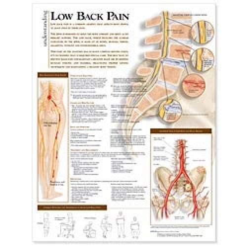 Wolter Kluwer Health Inc - 9780781782432 Anatomical Chart Understanding Low Back Pain 20 X 26 Inch Heavy Paper Grommets Laminated