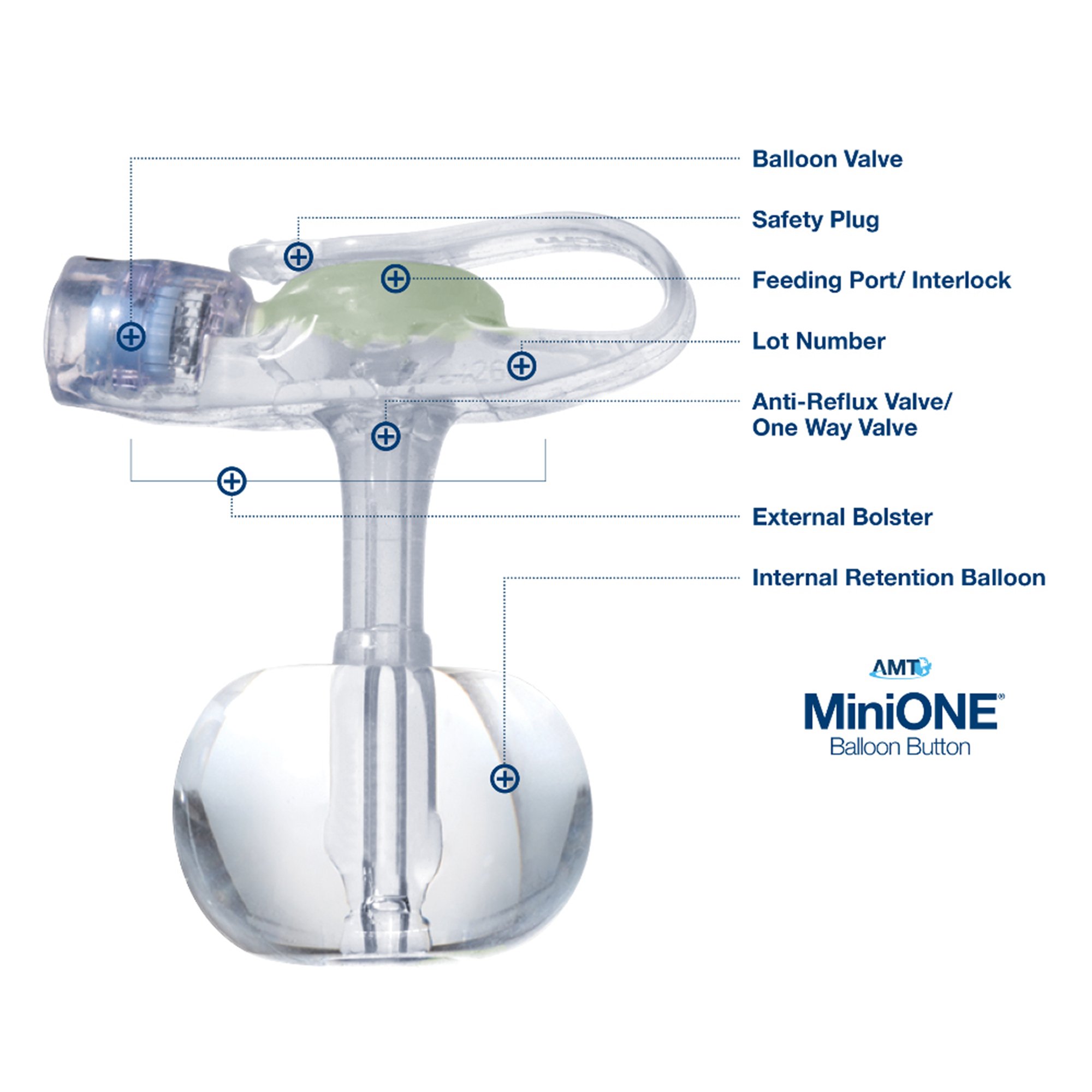 Applied Medical Technology Inc - M1-5-1810 Mini One® Low Profile Balloon Button Gastrostomy Tube Kit