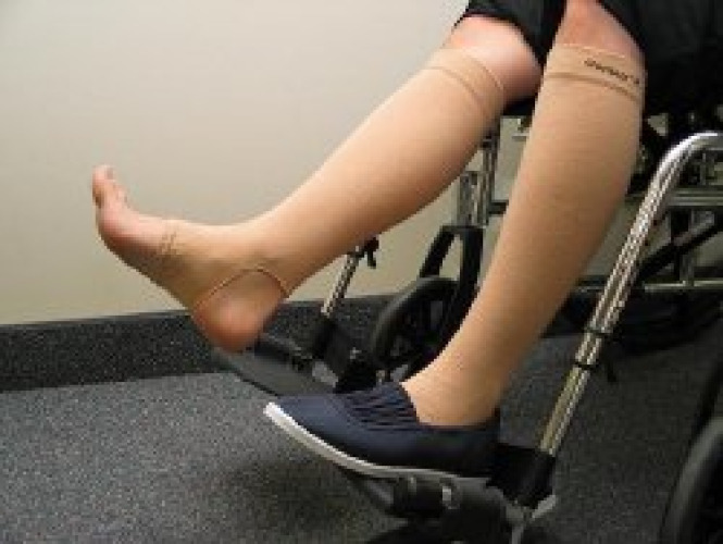 Prevent Products 20-500 - GeriLeg® Protective Leg Sleeve - 1/Pair