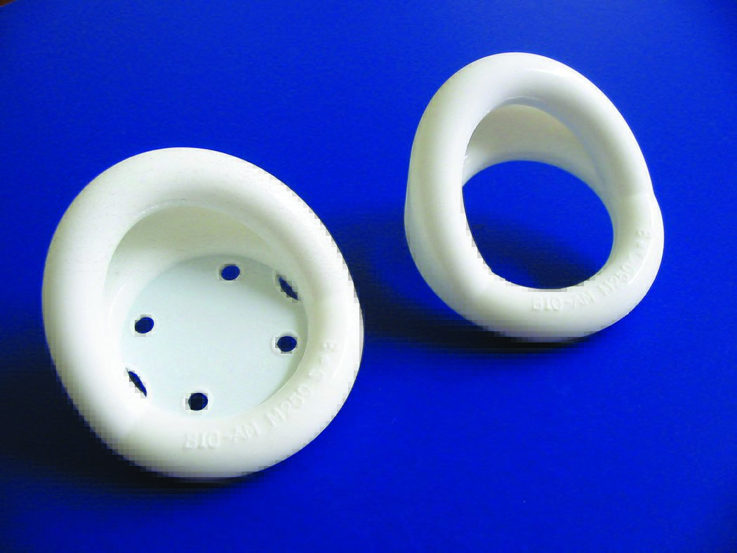 Integra Lifesciences 30-M5 - Integra® Miltex® Marland Pessary without Support, Size 5, 3 Inch - 1/Each