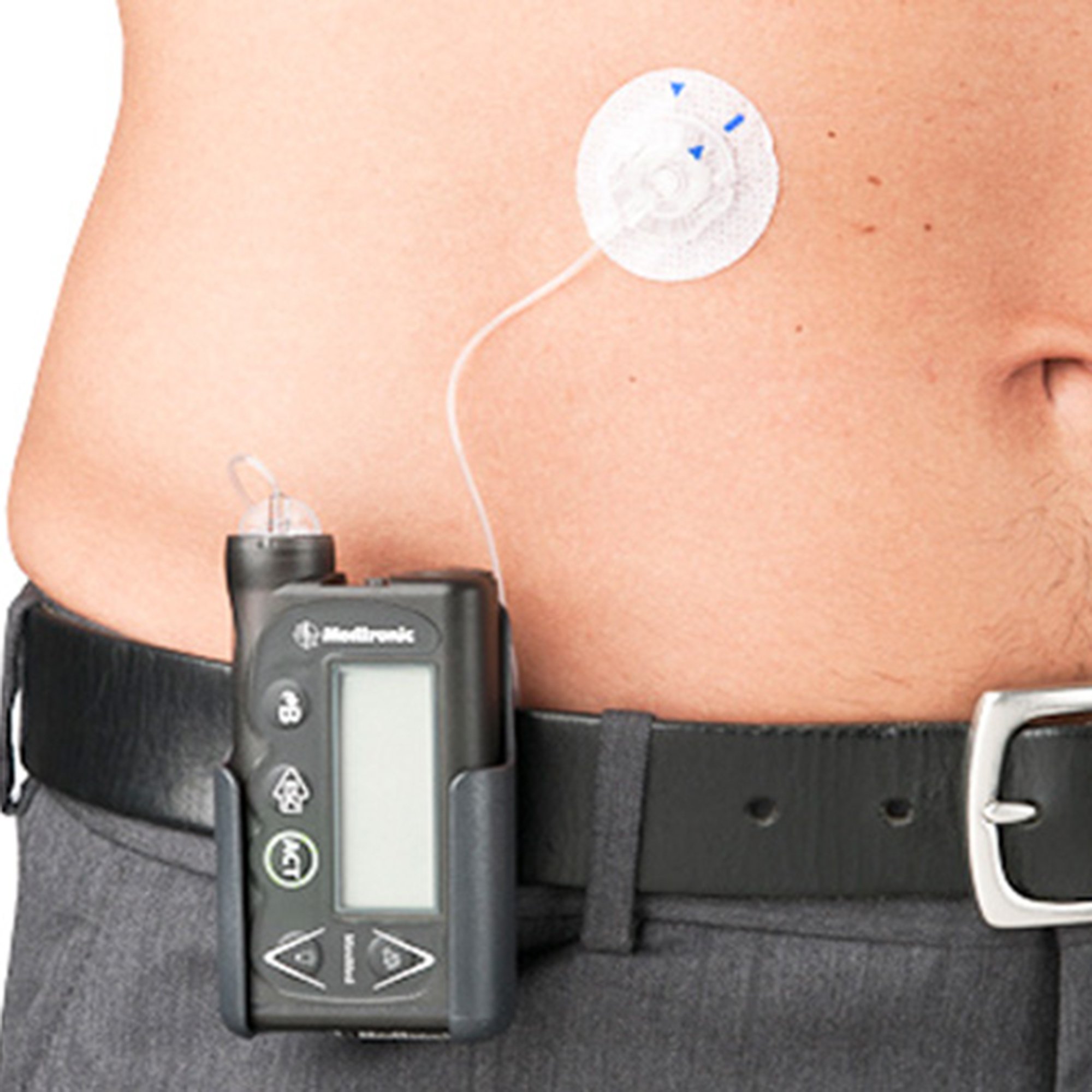 MiniMed Quick-set Insulin Infusion Set MMT-397A by Medtronic