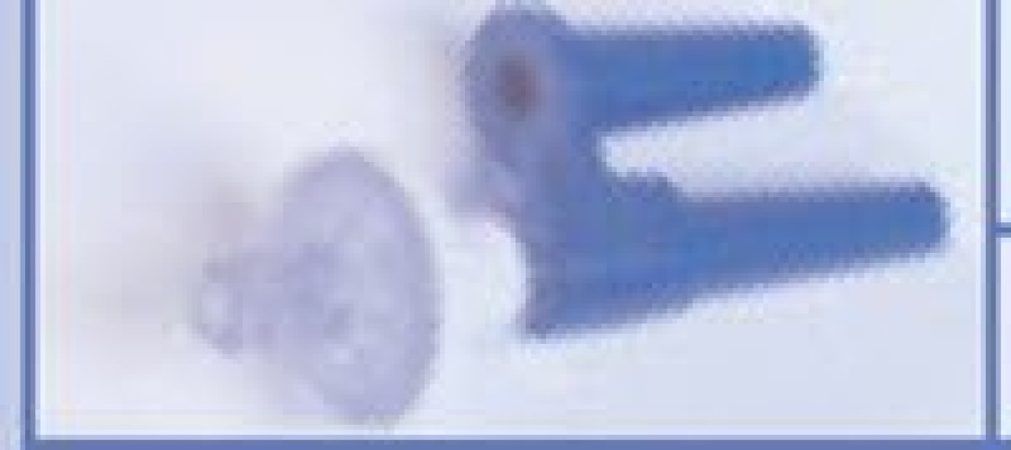 Bard - 0046000 Prevent® Anti-Reflux Filter for Bard Nasogastric Tubes