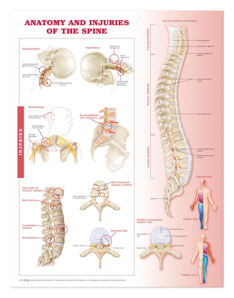 Wolter Kluwer Health Inc - 9780781786676 Anatomical Chart Anatomy and Injuries of the Spine 20 X 26 Inch Heavy Paper Grommets Laminated