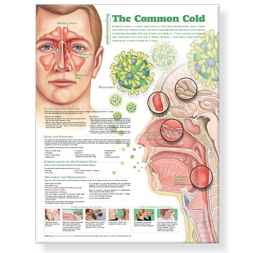 Wolter Kluwer Health Inc - 9780781786317 Anatomical Chart Understanding the Common Cold 20 X 26 Inch Heavy Paper Laminated