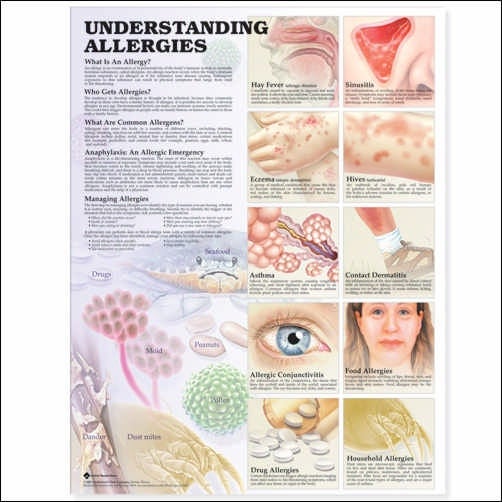 Wolter Kluwer Health Inc - 9781587799419 Anatomical Chart Understanding Allergies 2nd Edition 20 X 26 Inch Heavy Paper Laminated