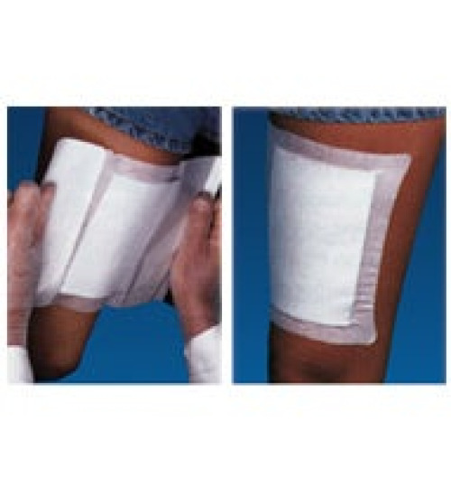 MPM Medical - MP00098 Island Dressing WoundGard® 6 X 6 Inch Square Sterile