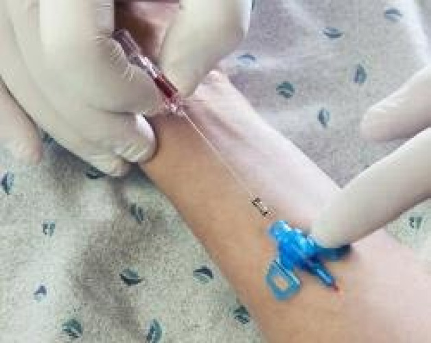 B. Braun - 4251129-02 Introcan Safety® 3 Closed IV Catheter
