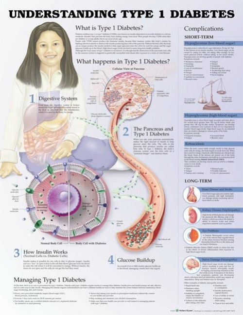 Wolter Kluwer Health Inc - 9781469894935 Anatomical Chart Type 1 Diabetes 3rd Edition 20 X 26 Inch Heavy Paper Grommets Laminated
