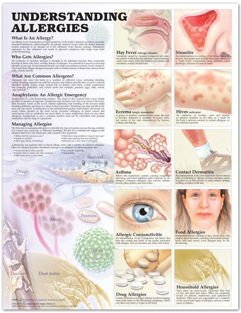Wolter Kluwer Health Inc - 9781587799402 Anatomical Chart Allergies 20 X 26 Inch Heavy Paper Grommets Laminated