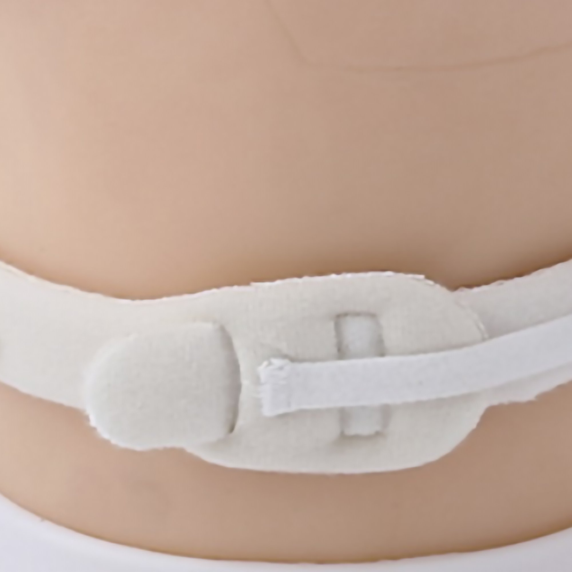Marpac 205D - Marpac Tracheostomy Tube Collar - 1/Each, 10/Box