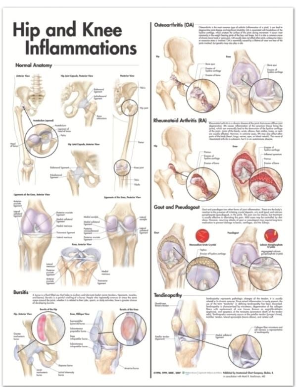 Wolter Kluwer Health Inc - 9780781773478 Anatomical Chart Hip and Knee 20 X 26 Inch Heavy Paper Grommets Laminated