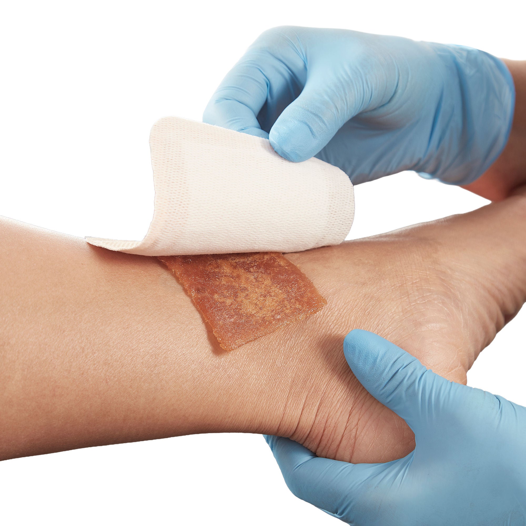 Mediusa - CR3818 Eclypse® Super Absorbent Wound Dressing