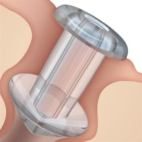 Oasis - 6614 Punctum Plug Soft Plug® 0.8mm, Medium, Silicone, Not Made with Natural Rubber Latex