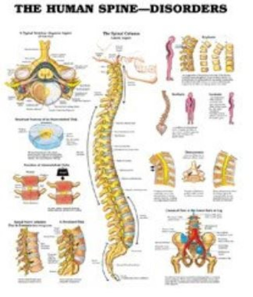 Wolter Kluwer Health Inc - 9781587794438 Anatomical Chart Human Spine 20 X 26 Inch Heavy Paper Grommets Laminated