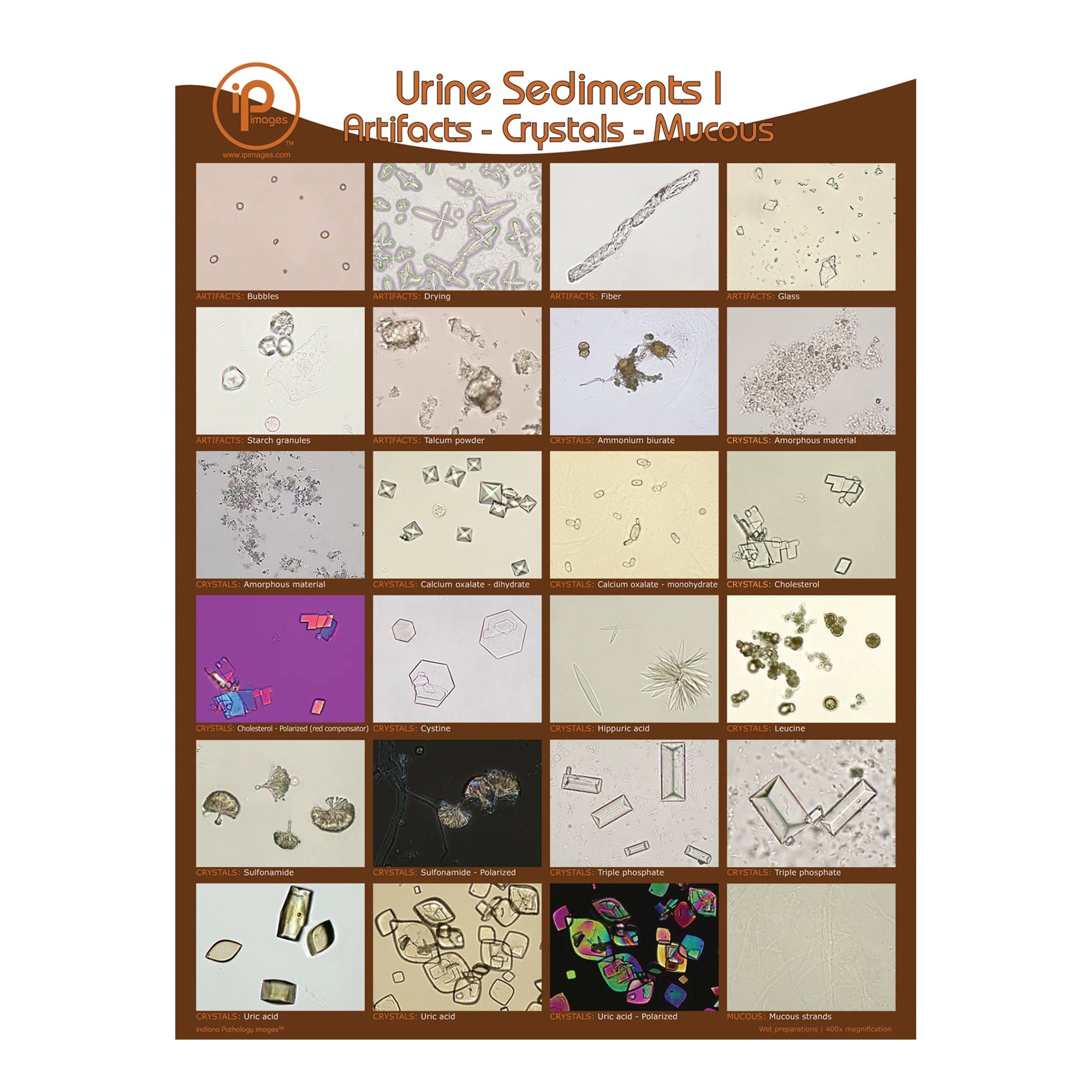 Market Lab Inc - 1887 Urine Sediments Charts Artifacts, Crystals, Mucous 18 W X 24 H Inch Wall Mount